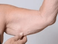 Perda de massa muscular em idosos… Saiba mais sobre&nbsp;sarcopenia!